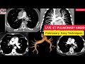 #live CT Pulmonary Angiography Easy Technique in Hindi || #ctpulmonaryangio @Radiologydept #ctscan