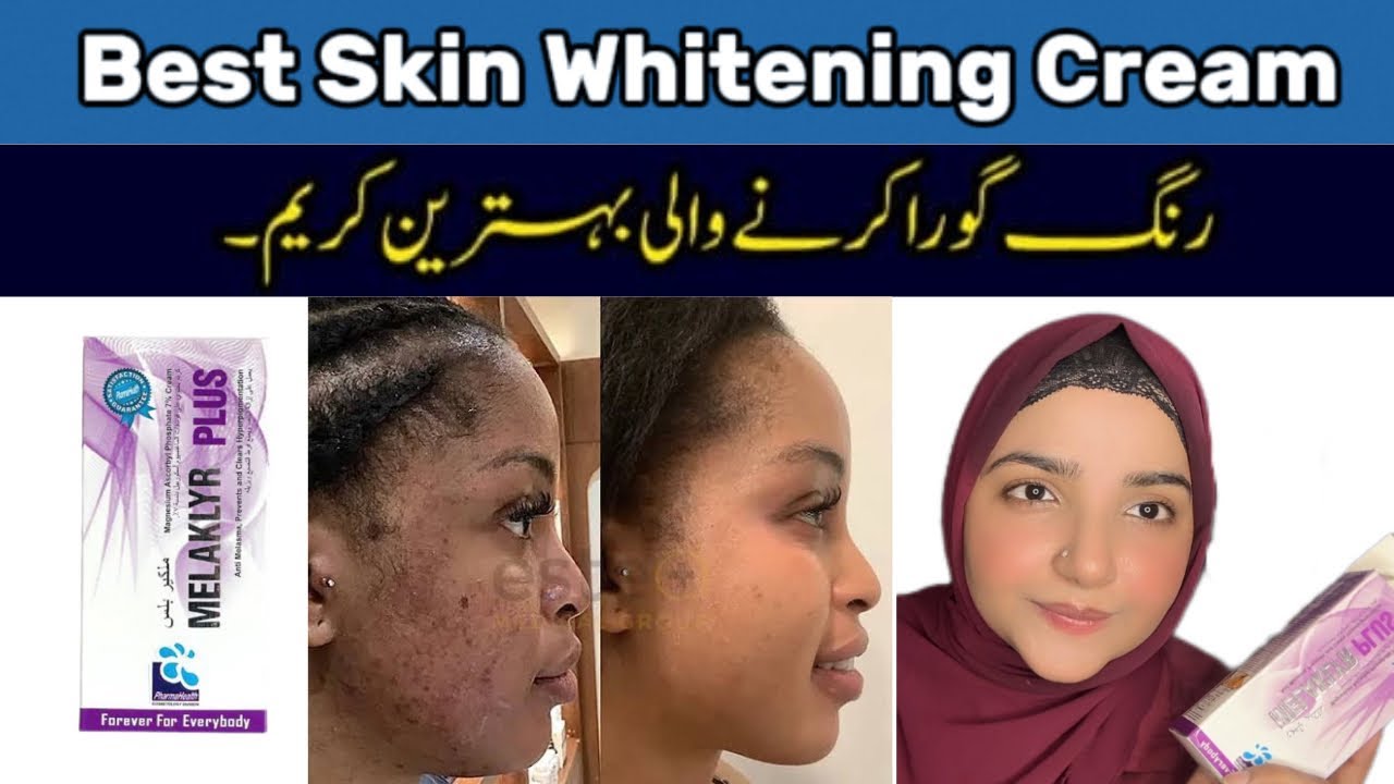 Best Whitening Medicated Cream Melaklyr Plus - For Melasma, Pigmentation, Freckles