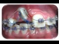sejnaui ortodoncia