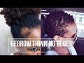 How To Regrow Thinning Edges | CHRISTIAN BYSHE