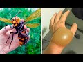 TOP 10 INSECTOS MÁS PELIGROSOS DEL MUNDO