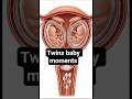 Twin Pregnancy Explained | Baby Development in the Womb