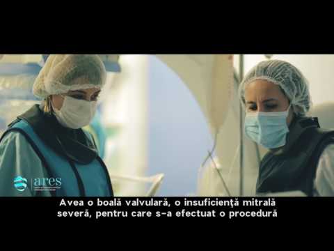 Video: Stenoza Valvei Mitrale: Cauze, Simptome și Diagnostic