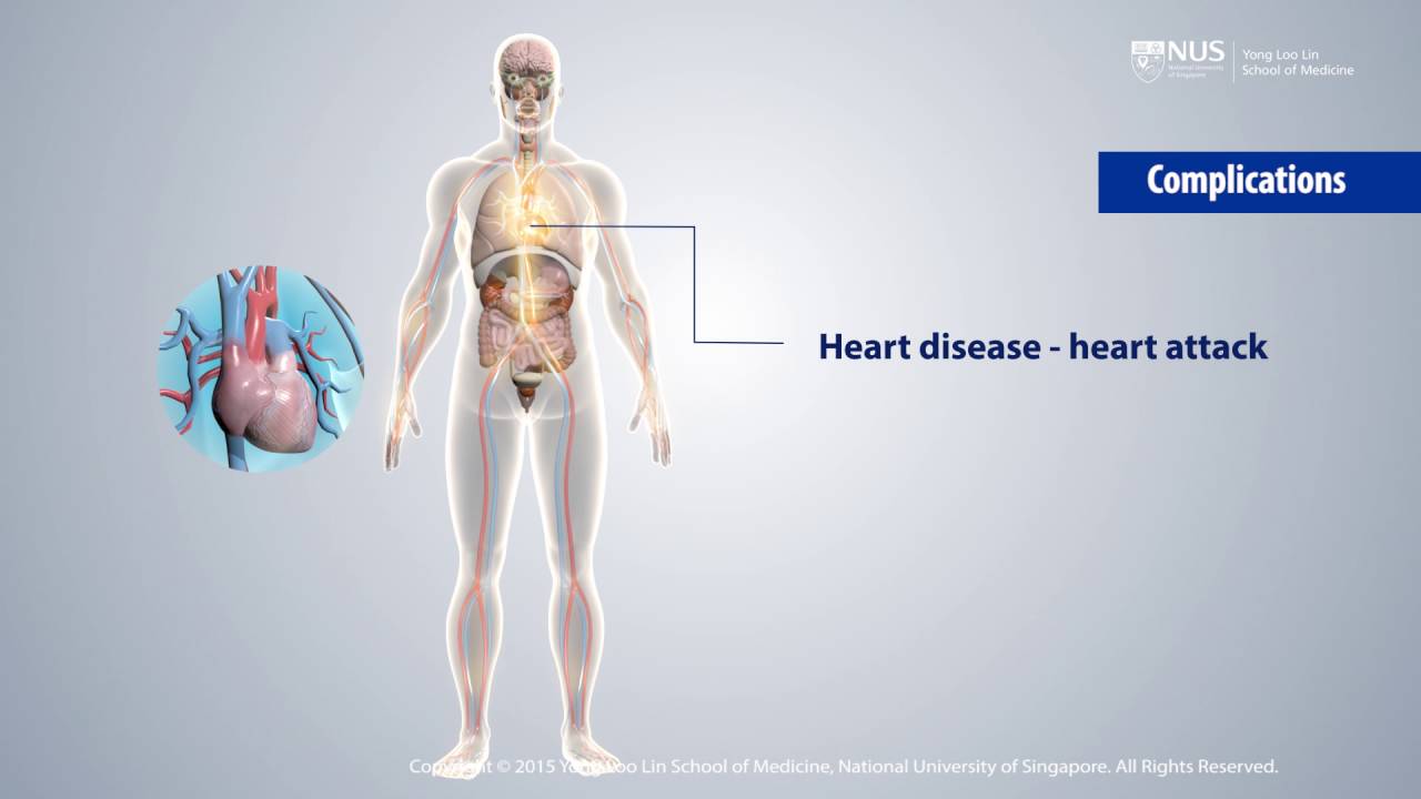 Diabetes Education YouTube