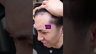 Tota Makes Fun Of Rays Forehead