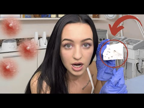 [ASMR] Blackhead Extractions & Nose Mask RP