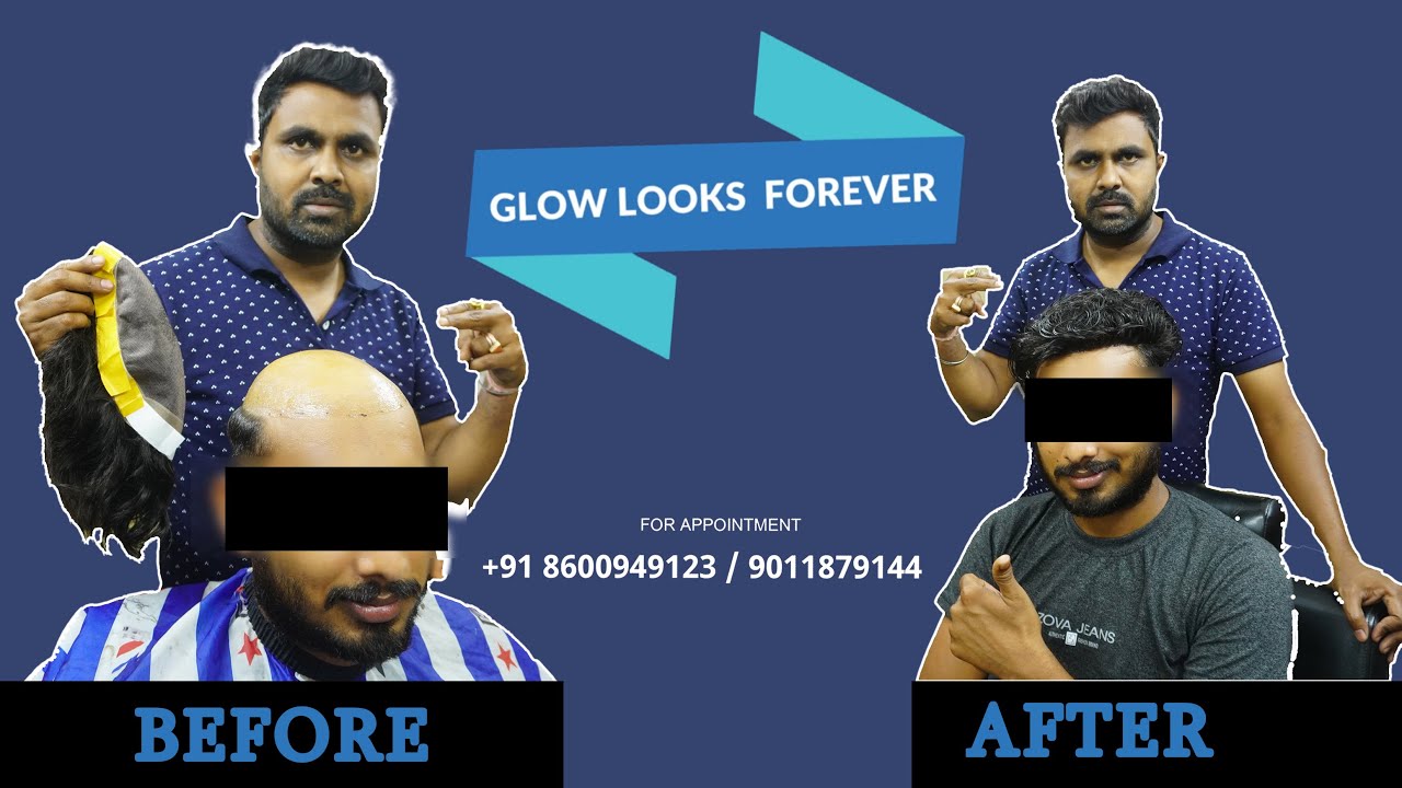 Non Surgical hair bonding Nagpur call 8600949123 Hair Wig Hair Patch