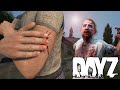 Blood Infections are a NIGHTMARE - Hardcore DayZ Survival Part 1