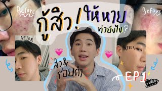 กู้สิวให้หายทำยังไง ? EP.1 l Extern Bahboh