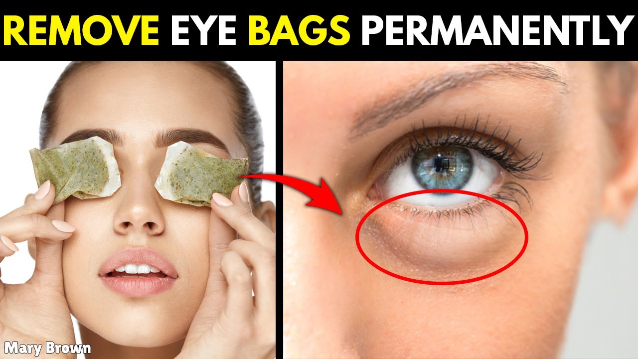 how-to-remove-eye-bags-permanently-youtube