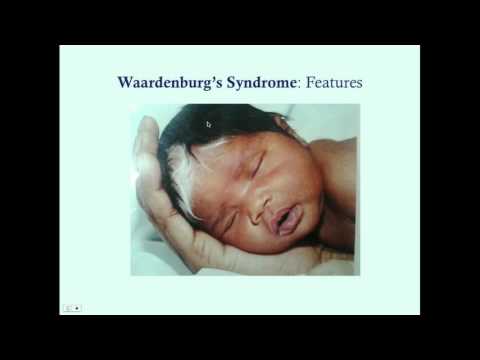 Waardenburg&rsquo;s Syndrome - CRASH! Medical Review Series