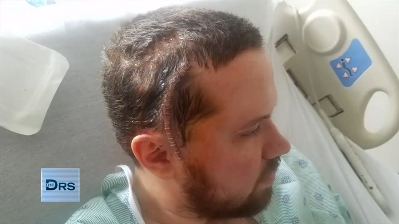 How Man'S Personality Changed After Life Saving Brain Surgery - Youtube