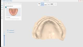 Full Denture Scan (ENG) screenshot 2