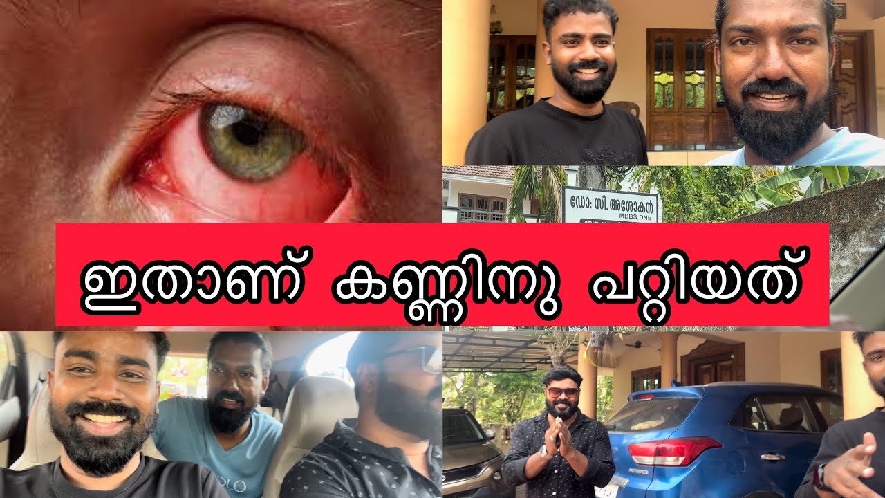 conjunctivitis in the eye treatment malayalam അപ്പോൾ കണ്ണിന്റെ കാര്യം
