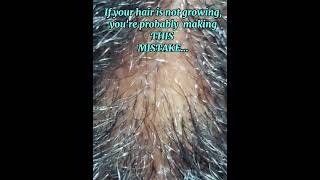 ❌️ STOP ✋🏽 Ruining your hair with poor scalp health! #trichologist #hairhealthtips #scalpcaretip