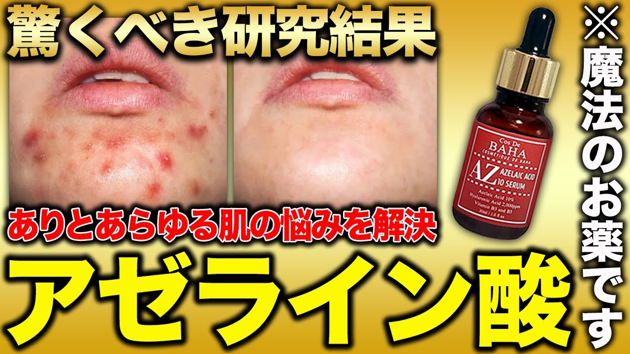 アゼライン 酸 効果