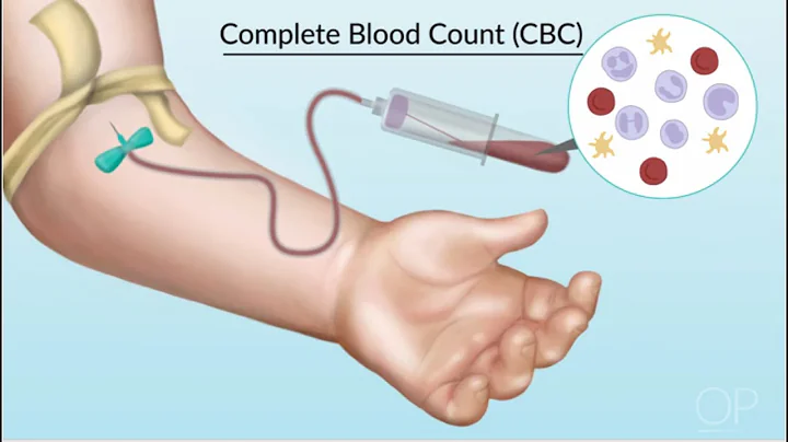 "Understanding Complete Blood Counts" by Laura Sto...