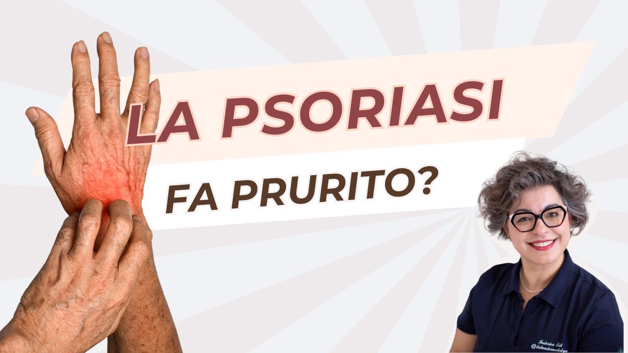 La psoriasi fa prurito?