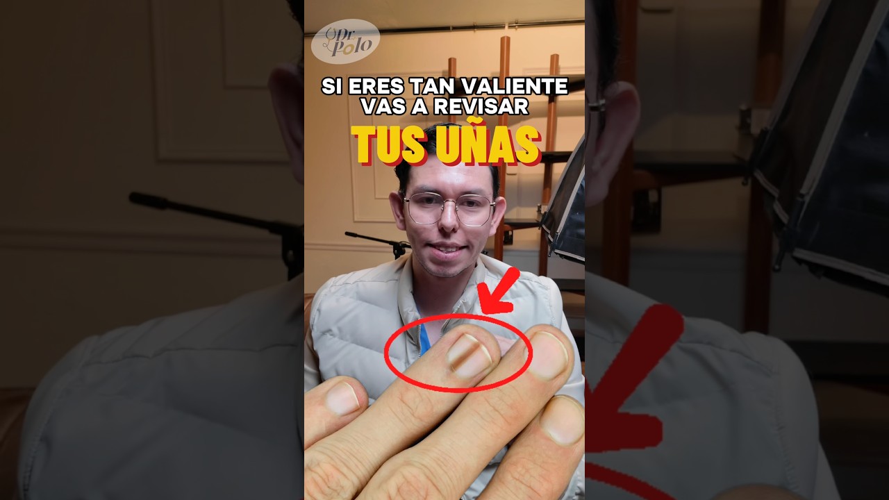 LINEA NEGRA en tu U&Ntilde;A! 🥹 m&aacute;s en IG  #medicina #sabiasque #curiosidades