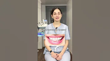 Какие брекеты выбрать❓🤔
