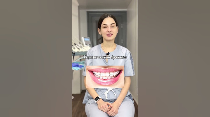 Какие брекеты выбрать❓🤔
