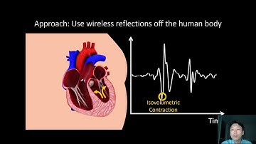 MobiCom 2020 - Short - Contactless Seismocardiography via Deep Learning Radars