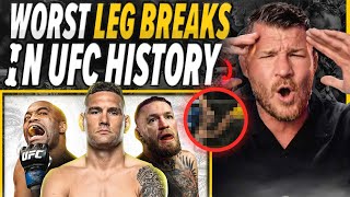 BISPING: THE MOST SHOCKING LEG BREAKS IN UFC HISTORY!