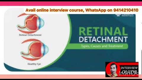 Retinal detachment | AMC interview questions | Army Doctor Interview | Interview Guide