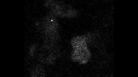 Spatial and temporal coordination of insulin granule exocytosis in intact human pancreatic islets