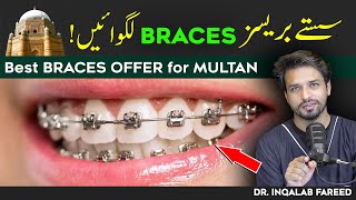 Best Braces Treatment in Multan! | Very Affordable | @InqalabFareed