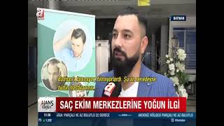 Ömer Uğur Saç Ekim A Haber Ekranlarında!