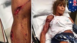 Kangaroo attack: Jogger gets 35 stitches from vicious mauling by 2m-tall crazy kangaroo - TomoNews