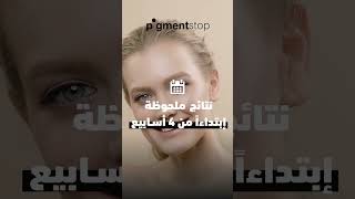 Bella Aurora Pigment Stop - الحل الفعال لمحاربة جميع بقع الوجه حسب نوع بشرتك