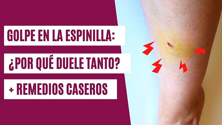 Golpe en la espinilla | ¿Por qué duele tanto y cómo aliviarlo?