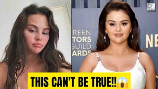 Download Lagu De verbluffende gezichtstransformatie van Selena Gomez: onthulling van voor en na! MP3