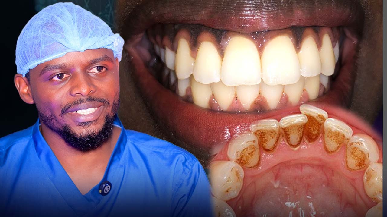 ISUKU YO MU KANWA| DR.ERNEST