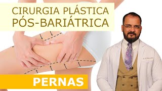 Cirurgia Plástica Pós-bariátrica - Pernas