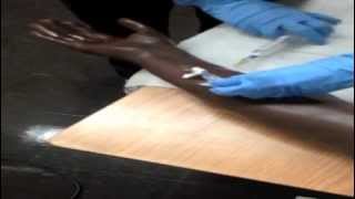 IV Catheter Insertion N3170 Fall2012