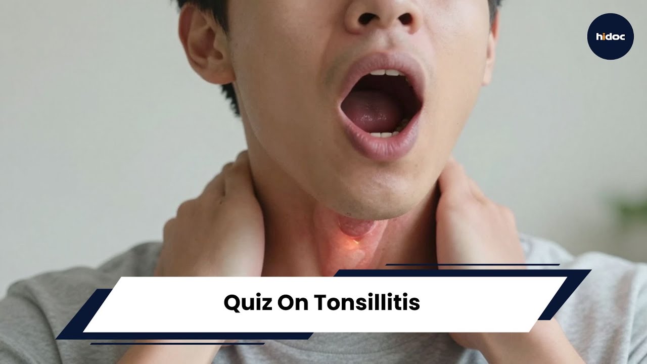 Quiz On Tonsillitis