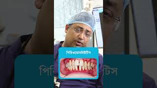 মাড়ি থেকে রক্ত পড়ার কারণ জেনে নিন | Causes for bleeding gums | Dactar Babu | Ep.:552
