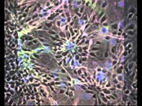 nodes of randivir by synapse.wmv