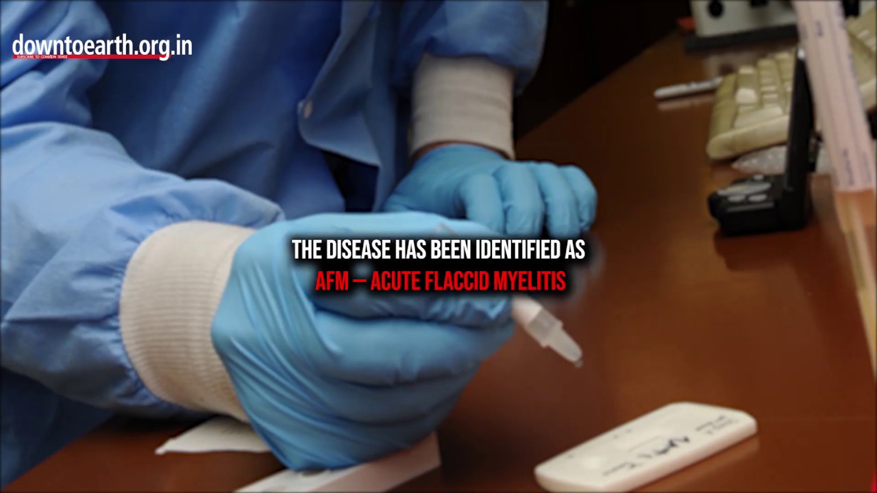 What is this mysterious disease AFM all about? YouTube