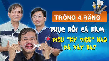 Trồng 4 răng phục hồi nguyên hàm | Mất răng toàn hàm