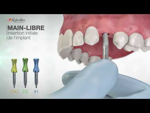 Alphabio France , implant dentaire