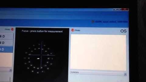 Lenstar optical biometry
