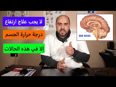 لا يجب علاج الحمى إلا في الحالات التالية
