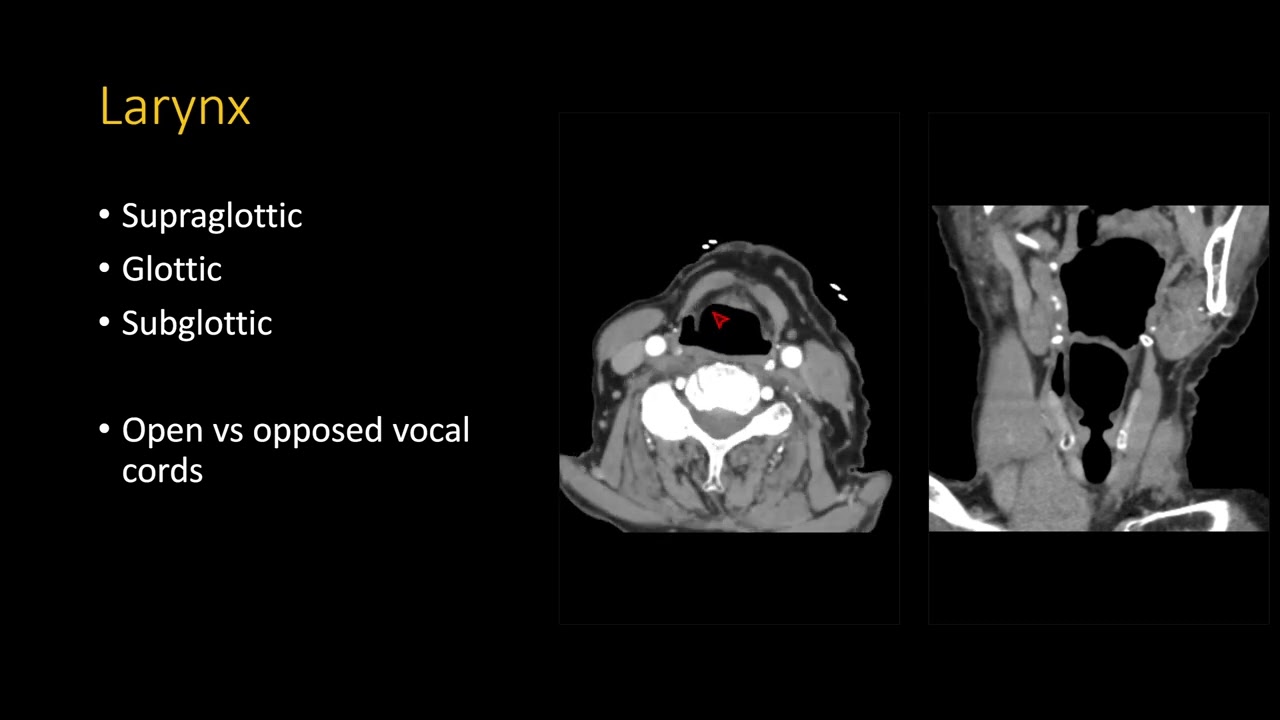 Neck CT search pattern