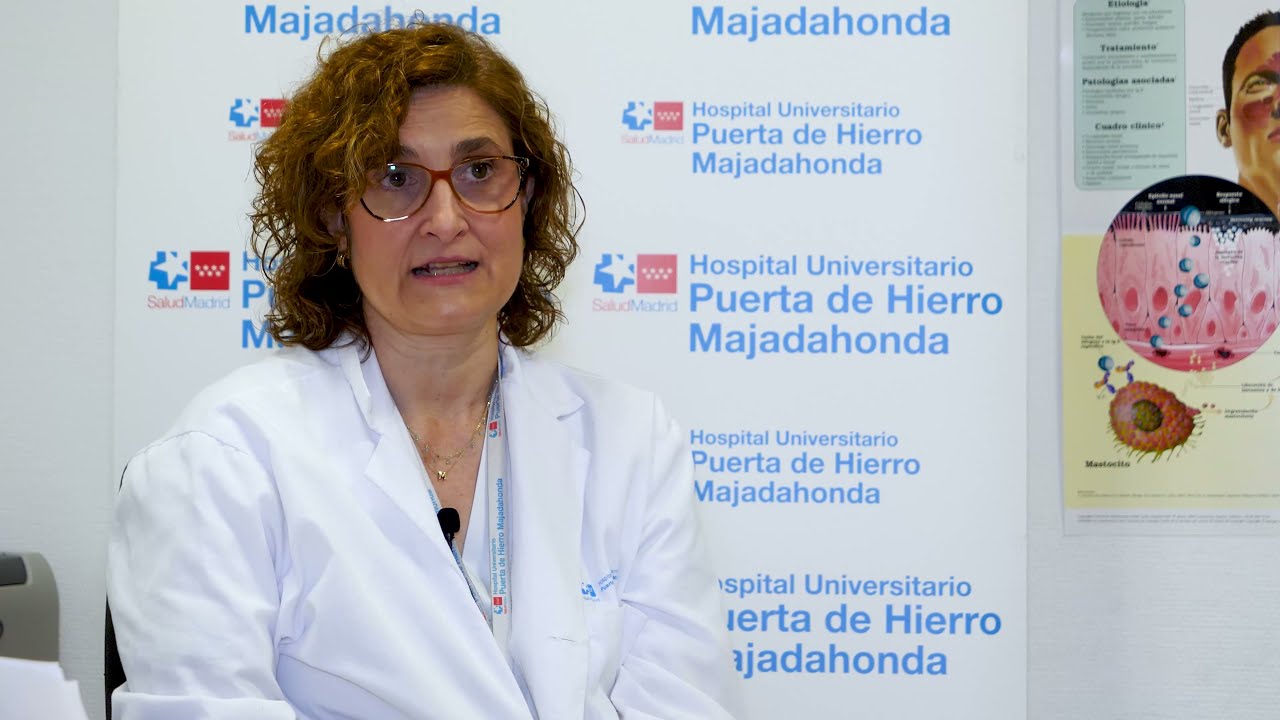 Rinitis alérgica: síntomas, diagnóstico y tratamiento