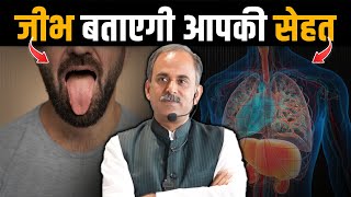 Tongue Diagnosis👅: Early Warning Signs of Internal Disorders | Acharya Manish JI