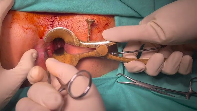 Bachadon ultratovush porno Yashirin kamera qizning külotlarini suratga oladi